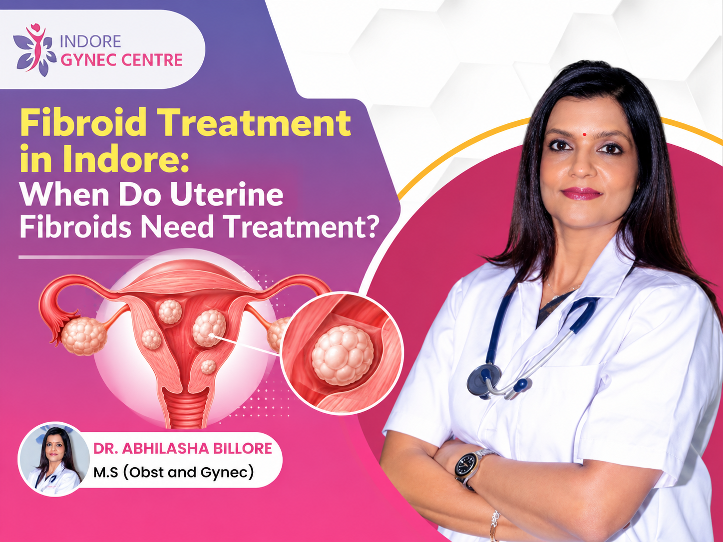 Fibroid Treatment in Indore for Uterine Fibroids