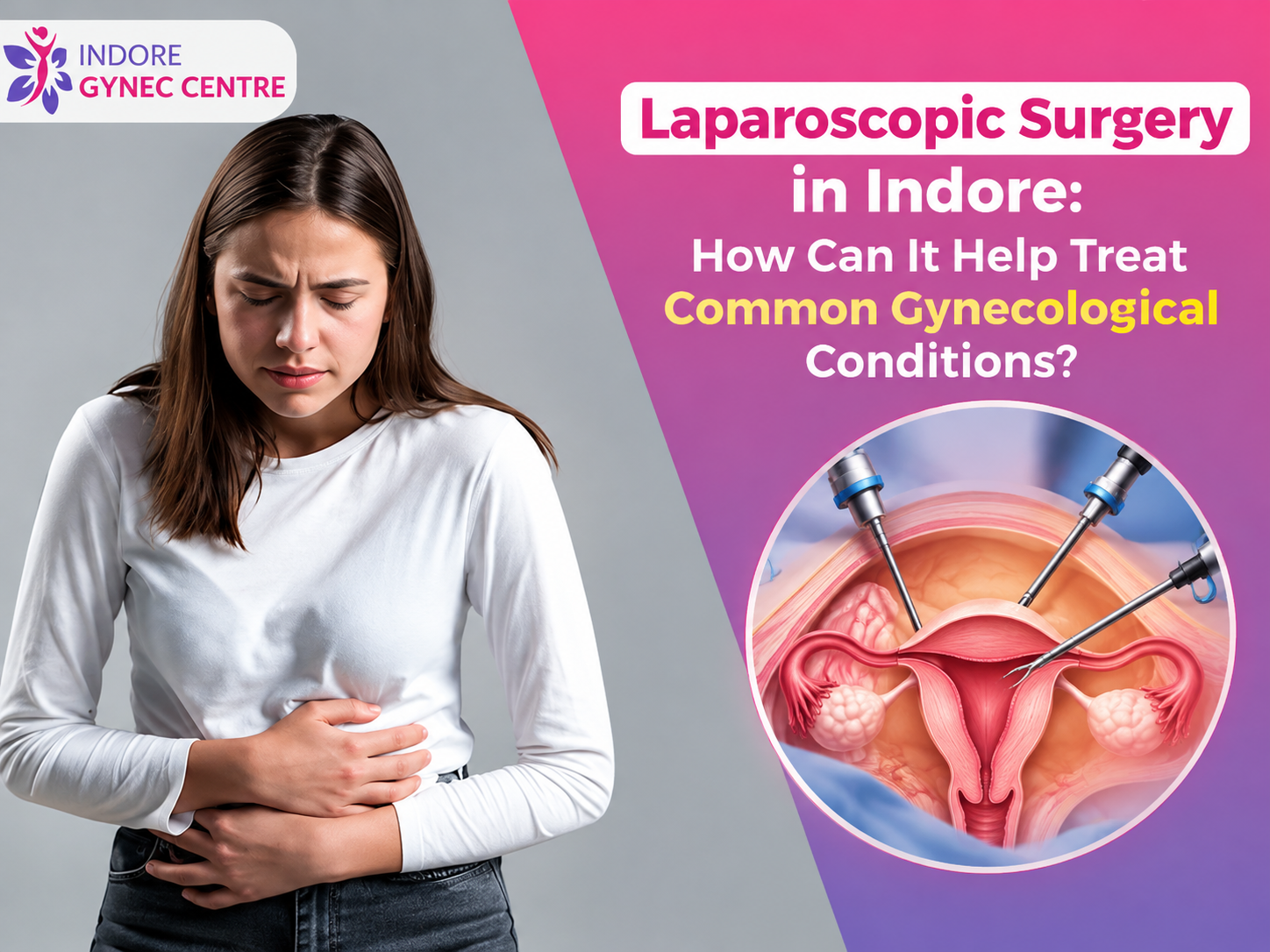 Laparoscopic Surgery in Indore for Common Gynecological Conditions